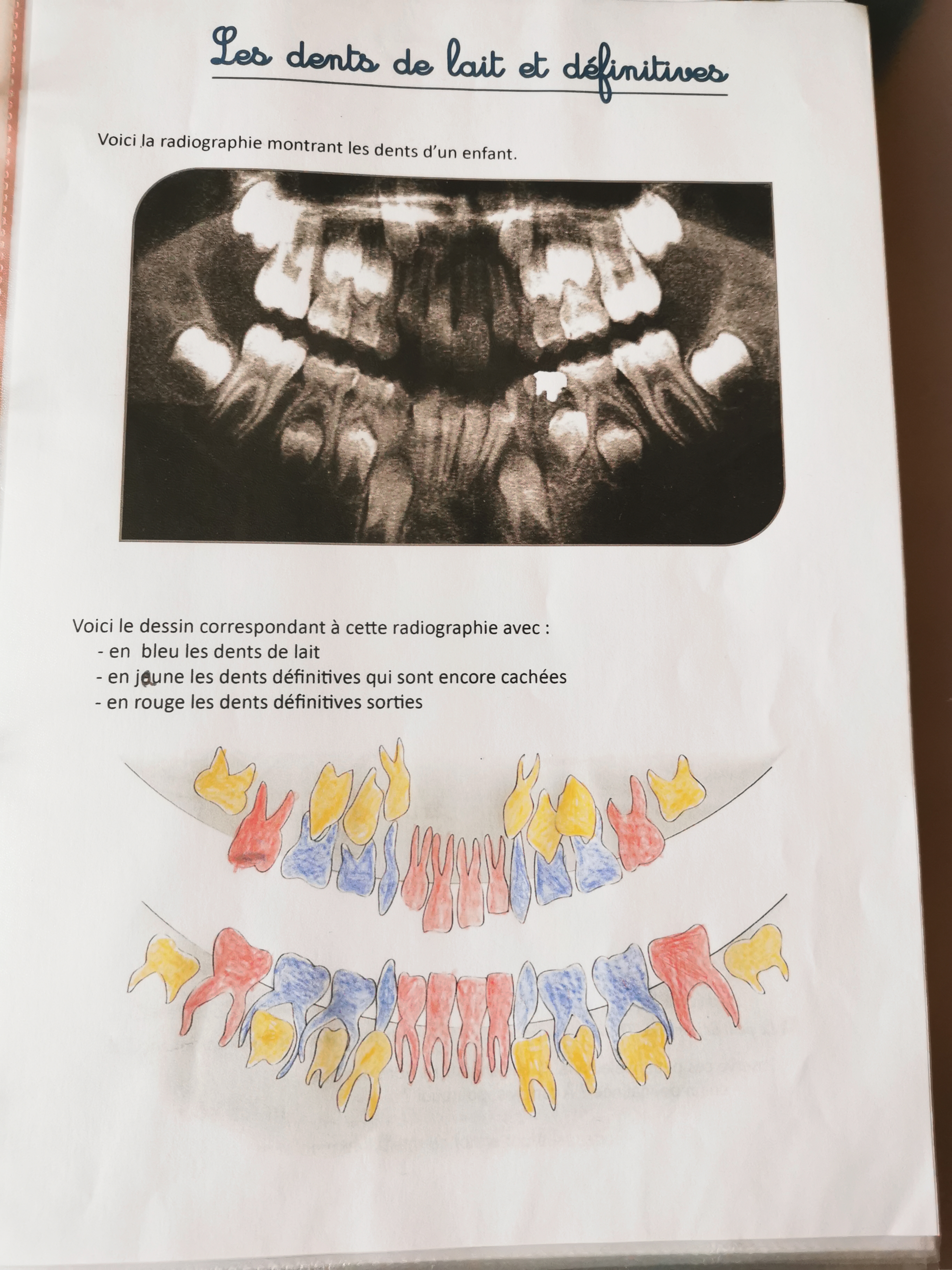 radiographie de la bouche